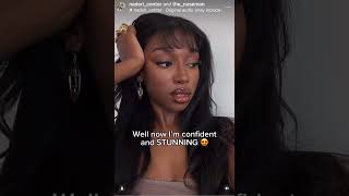 African American Rhinoplasty Patient Before & After