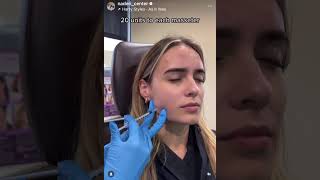 Botox for natural looking wrinkle reduction