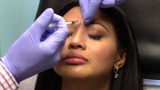 Botox for Prevention of Lines and Wrinkles in Young People Bethesda Maryland