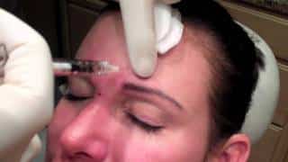 Botox Injection in Northern Virginia