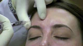 Botox Injection Technique for Wrinkle Reduction