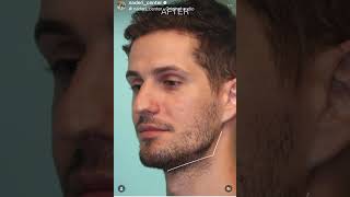 Defining Masculine Features with Fillers
