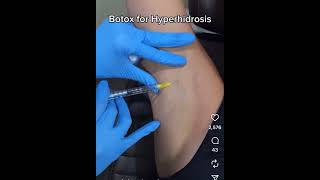 Finally stop excessive sweating Botox for Hyperhidrosis