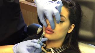 Gentle Micro-Droplet Lip Injections by Clinical Injections Instructor Dr. Naderi