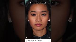 Harmonious transformation Asian Rhinoplasty results with Dr Naderi