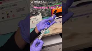 Injectable PRP Treatment Before & After Amazing results