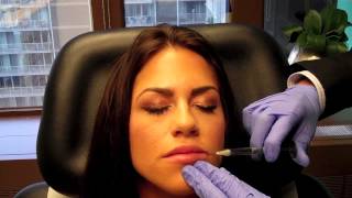 Juvederm Lip Injection Dr Naderi Maryland Virginia Washington DC