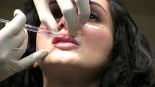 Juvederm Ultra XC Lip Augmentation Filler Injection in Washington DC