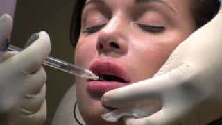 Lip Augmentation & Wrinkle Reduction using Juvederm Ultra