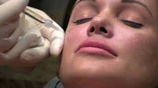 Liquid Midface Lift (Cheek Augmentation with Perlane)