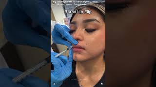 Masseter Botox & Lip Flip Achieve facial harmony