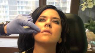 Minimal Pain or Bruise Lip Injection Washington DC Expert Cosmetic Surgeon