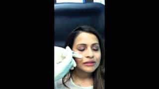 Under eye dark circle injections Maryland