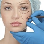 Benefits of Blepharoplasty