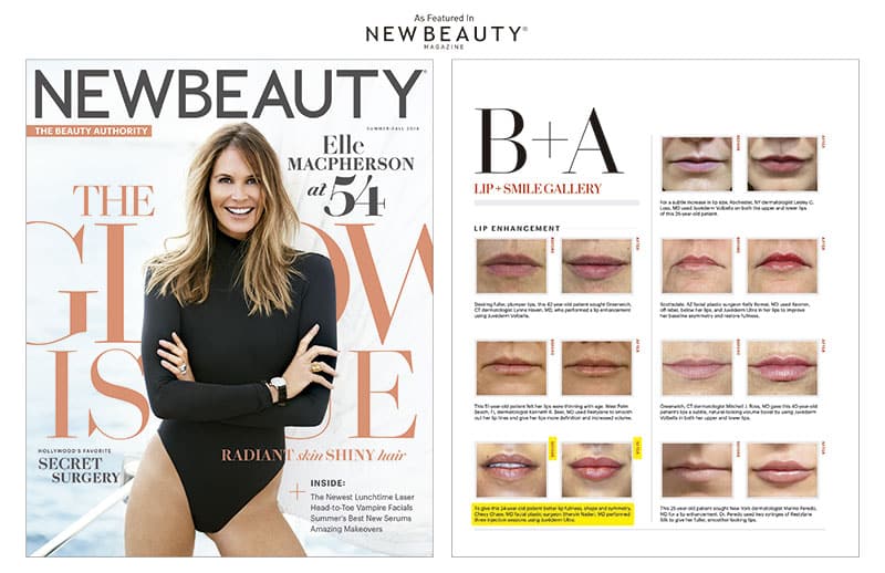 The Naderi Center in Virginia and Maryland for Plastic Surgery and Dermatology is often featured in New-Beauty magazine