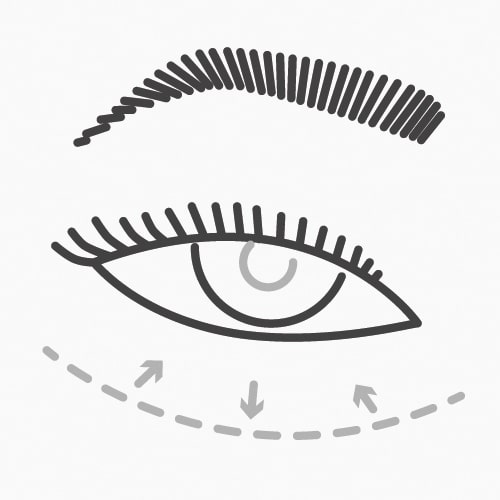 Eyelid Pre & Post Procedure Instructions