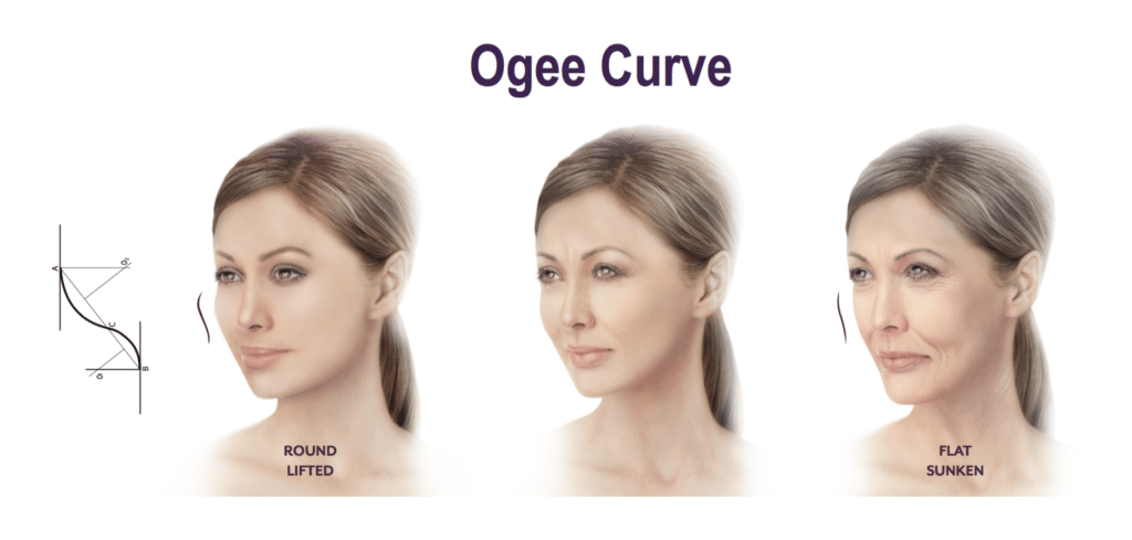 The ogee curve describes the double soft-S curves that are typically found on youthful faces when viewed from an oblique angle.  As we age the the fullness seen on the upper check starts to flatten and become more sunken.  