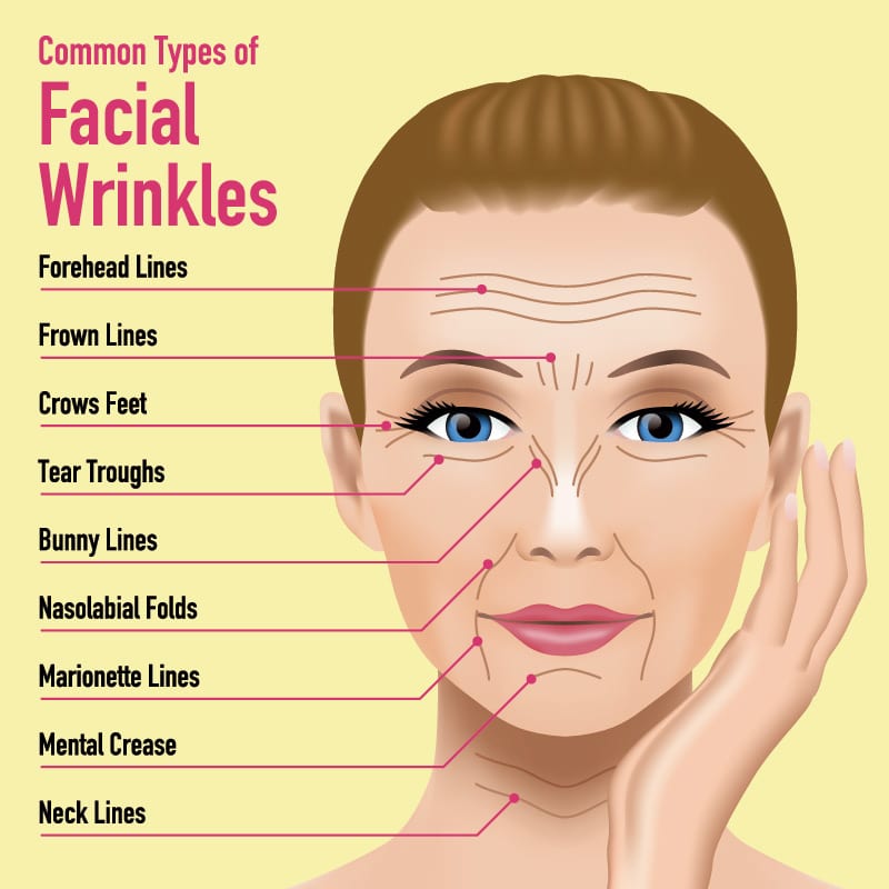 Wrinkles that can be addressed at The Naderi Center in Virginia and Maryland