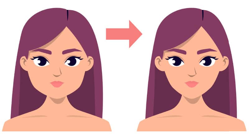 Botox can help smoothen jaw line, creating a less square face