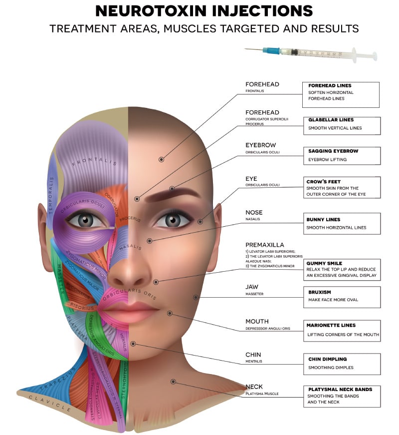 Wrinkles that can be addressed at The Naderi Center in Virginia and Maryland