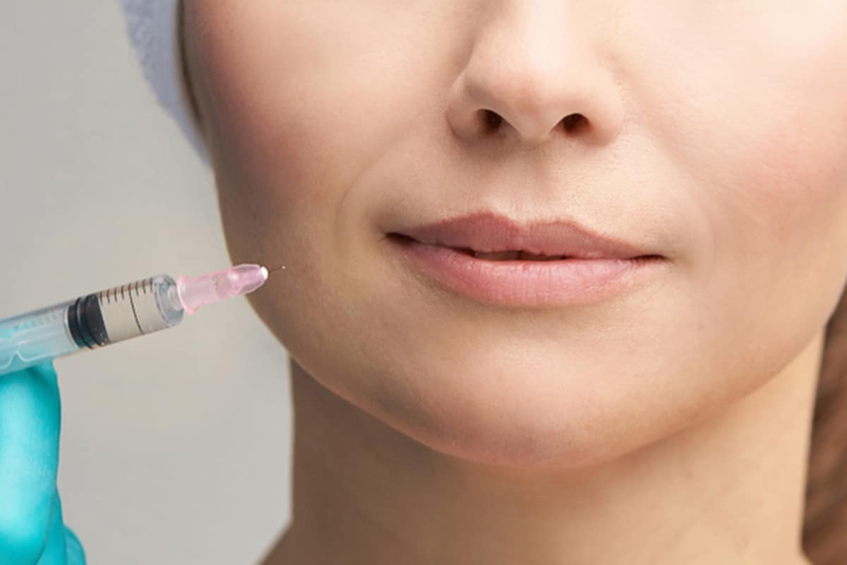 الرادييس والفيلر