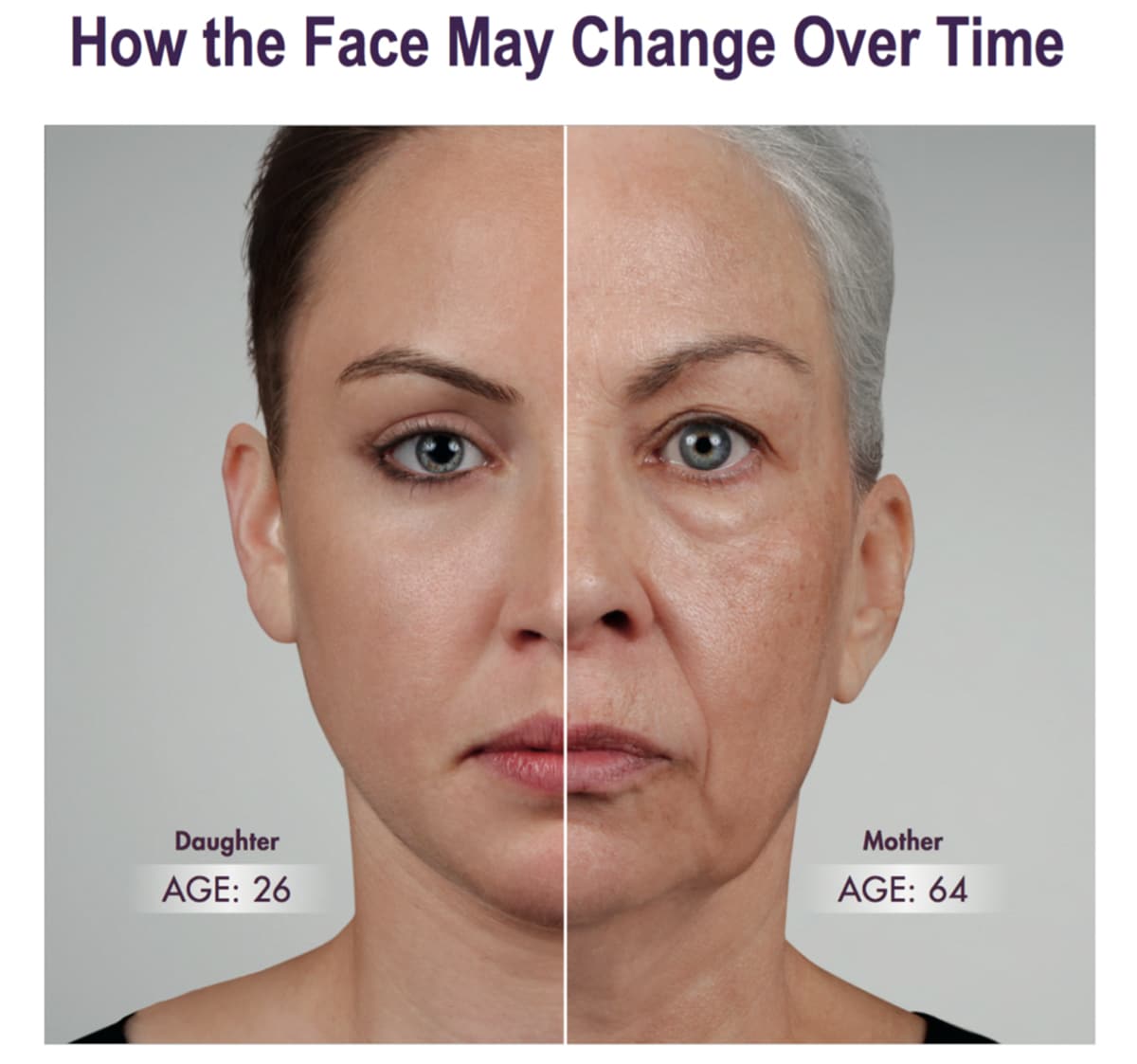 Juvederm | Virginia, Washington D.C. and Maryland