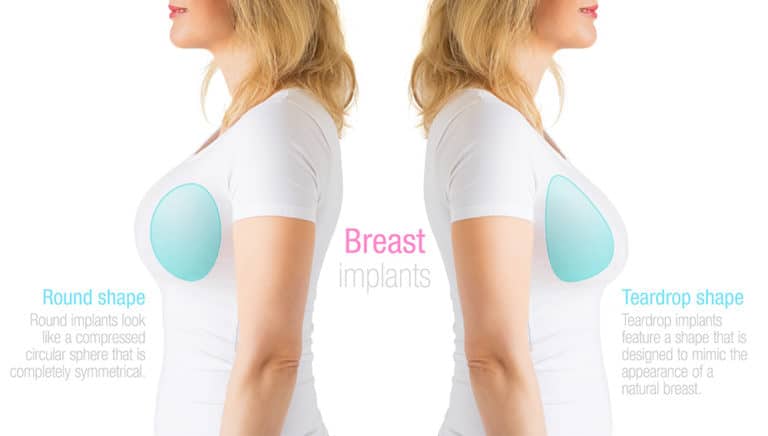 breast shapes and sizes pictures breast shapes and sizes pictures