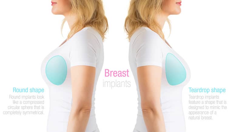 Breast Implant Types Northern Virginia Washington Dc The Naderi Center 