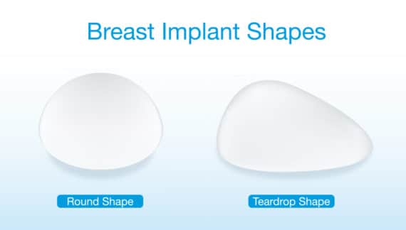 Breast Implant Types - Northern Virginia- Washington DC - The Naderi Center