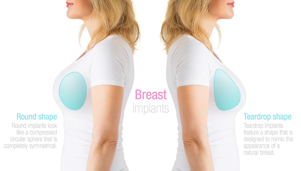 Gummy Bear Implants vs Regular Implants