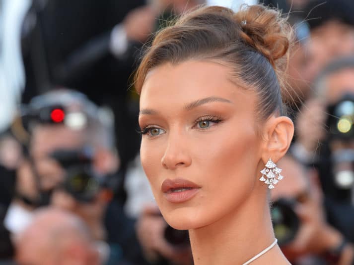 Bella Hadid after Buccal Fat Pad Removal