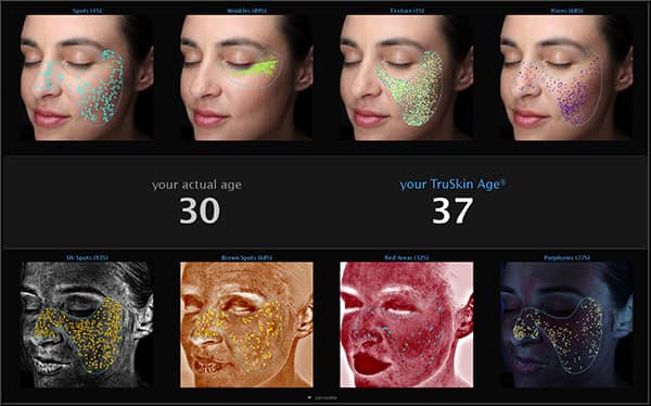 VISIA® skin analysis provides patients with a "skin age" based on how their skin compares to other individuals with their age and skin type. The Naderi Center in Virginia and Maryland 