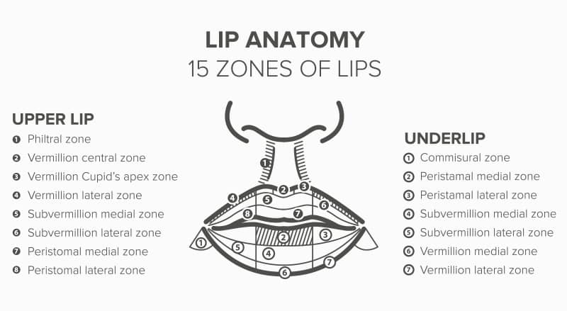 Diagram demonstrates potential anatomical locations where lip filler can be injected.