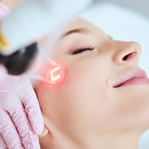 CO2 Laser Skin Resurfacing