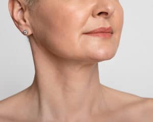 Close view of a neck and jawline in profile