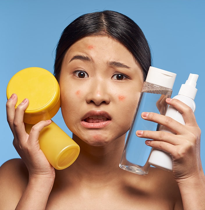 Emotional Stresses of Acne Scarring