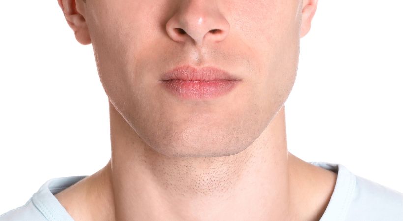 Male chin with enhanced definition after non-surgical dermal filler augmentation for a masculine profile.