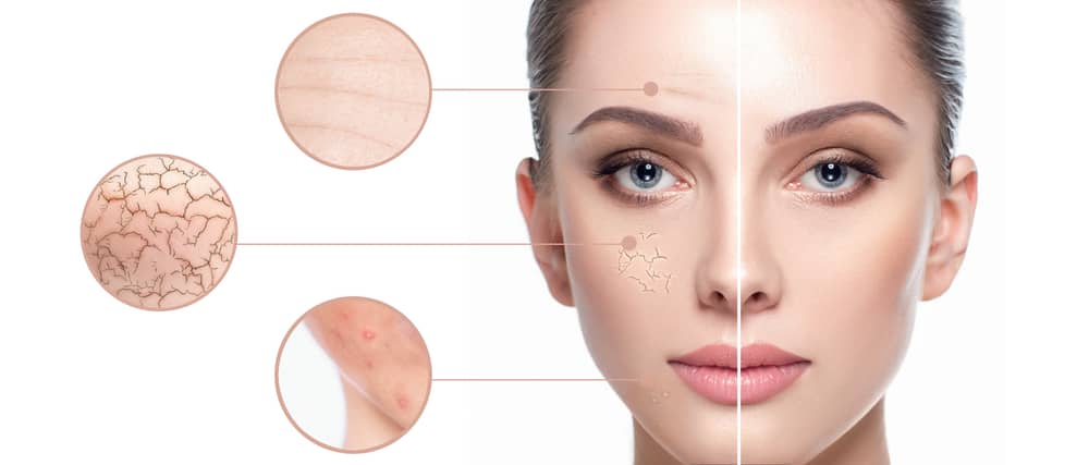 Split-face comparison showing treated and untreated skin with insets of texture, wrinkles, and discoloration for laser results.