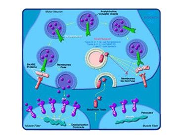 Diagram showing how Botox blocks neurotransmitter release at nerve endings, preventing muscle contraction and causing relaxation