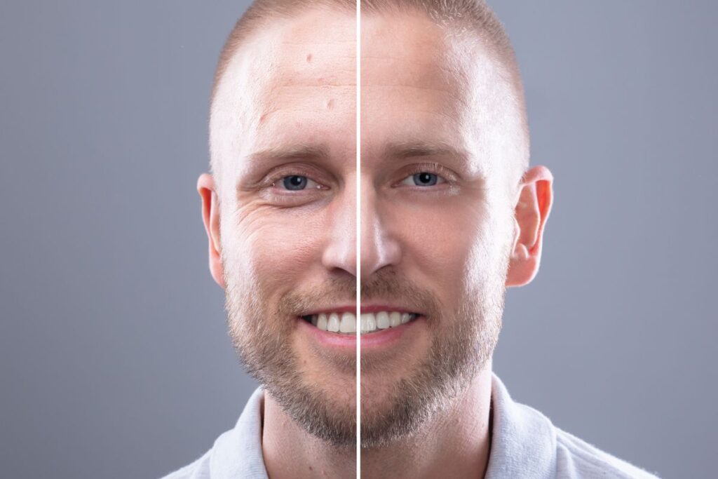 Side-by-side comparison of a man before and after Brotox treatment, showing smoother skin and refreshed appearance