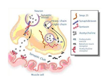 Diagram of botulinum toxin inhibiting acetylcholine release at neuromuscular junction between neuron and muscle cell