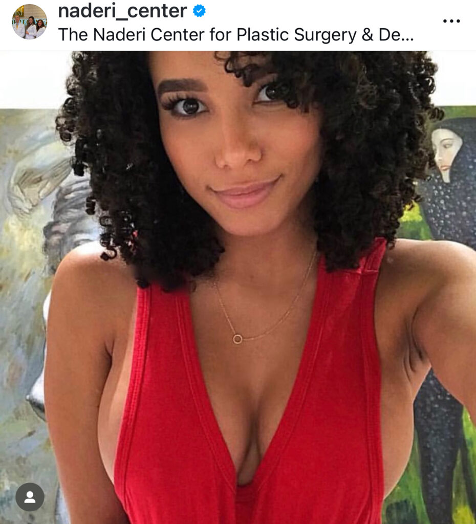 Woman with curly hair in red top, representing common African nasal features and advanced rhinoplasty considerations.
