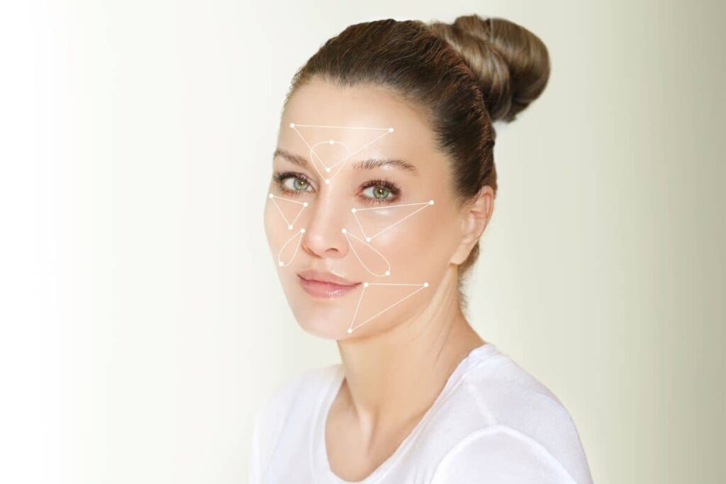 Woman with facial mapping lines illustrating common Botox injection zones for wrinkle treatment and facial contouring.