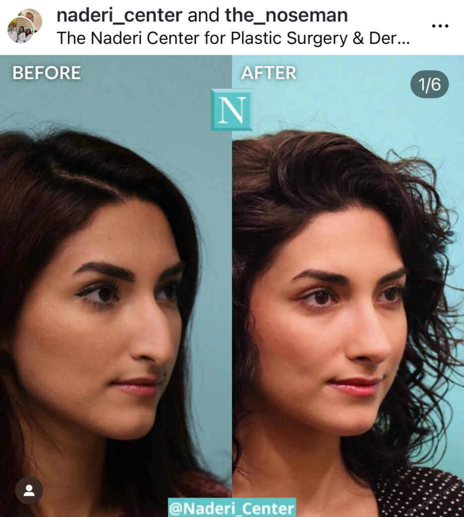 Before & After Real Patient