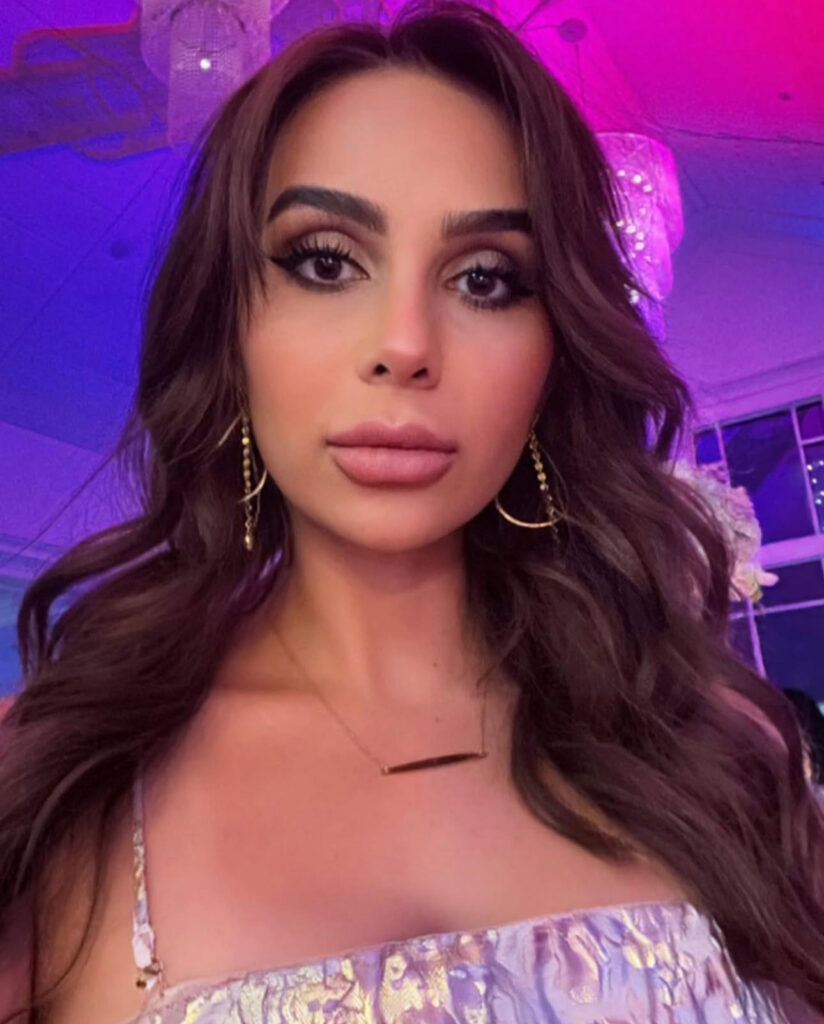 Persian rhinoplasty real patient