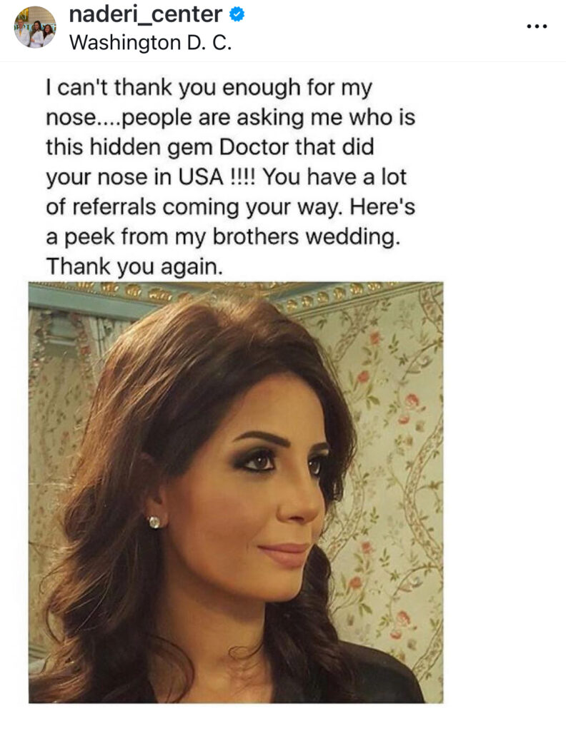 Persian rhinoplasty real patient
