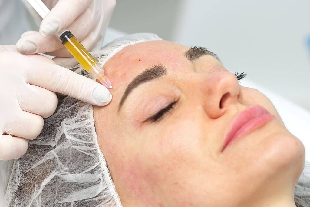 Practitioner performing PRF injection on under-eye area to improve skin texture and support collagen production