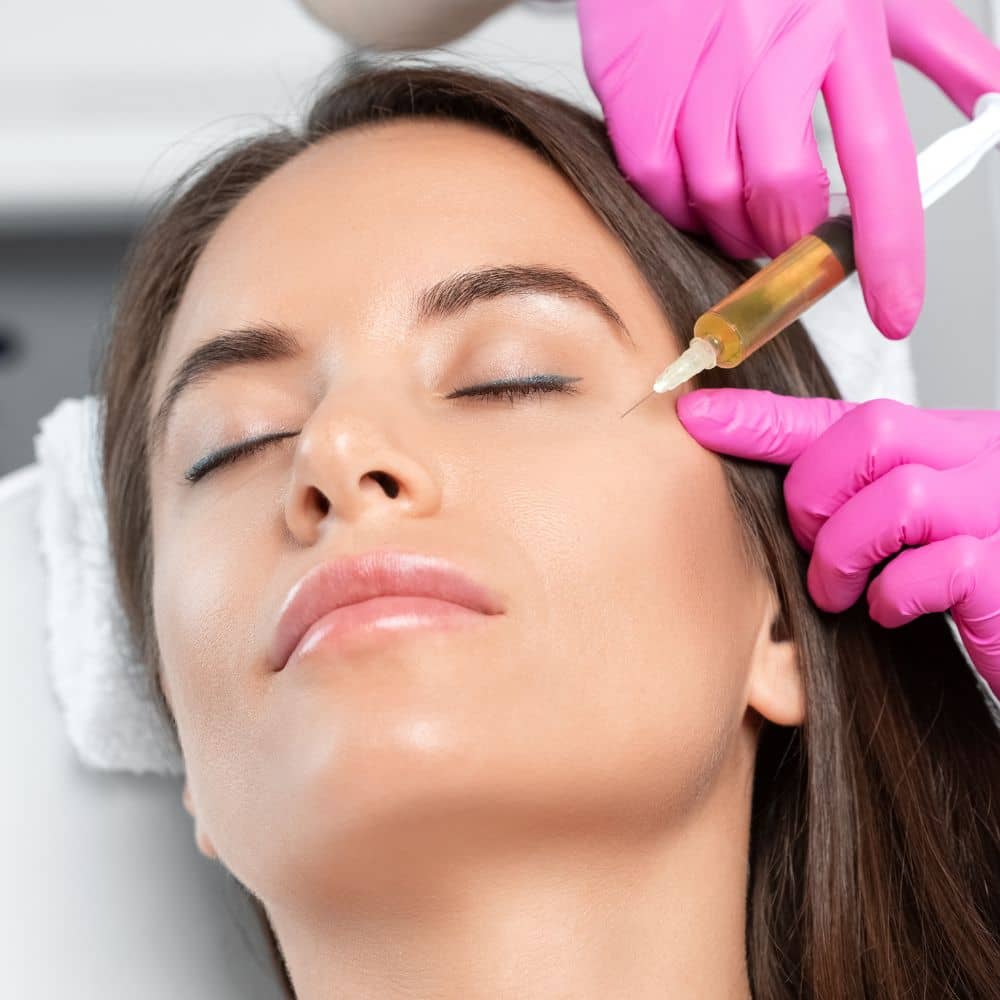 PRF injection being administered under the eye to improve skin quality and stimulate natural collagen production.