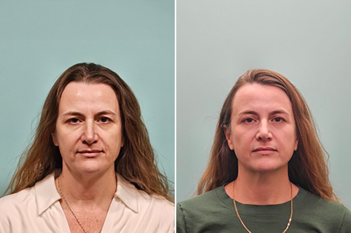 Before and after Skin Resurfacing by Dr. Shervin Naderi, Patient 50261