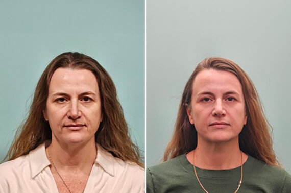 Before and after Skin Resurfacing by Dr. Shervin Naderi, Patient 50261
